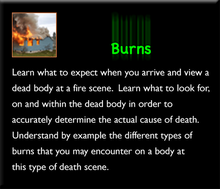 Load image into Gallery viewer, Deaths by Burns and Electrocution Set
