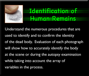 Identification of Human Remains Set