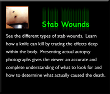 Load image into Gallery viewer, Deaths by Sharp Force Trauma Set