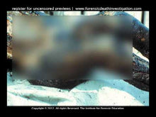 Load and play video in Gallery viewer, Deaths by Burns and Electrocution Set