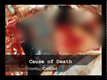 Load and play video in Gallery viewer, Deaths by Sharp Force Trauma Set