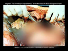 Load and play video in Gallery viewer, Deaths by Blunt Force Trauma Set