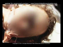 Load and play video in Gallery viewer, Identification of Human Remains Set